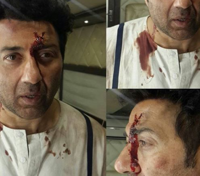 Sunny Deol's prosthetics makeup in Ghayal Once Again